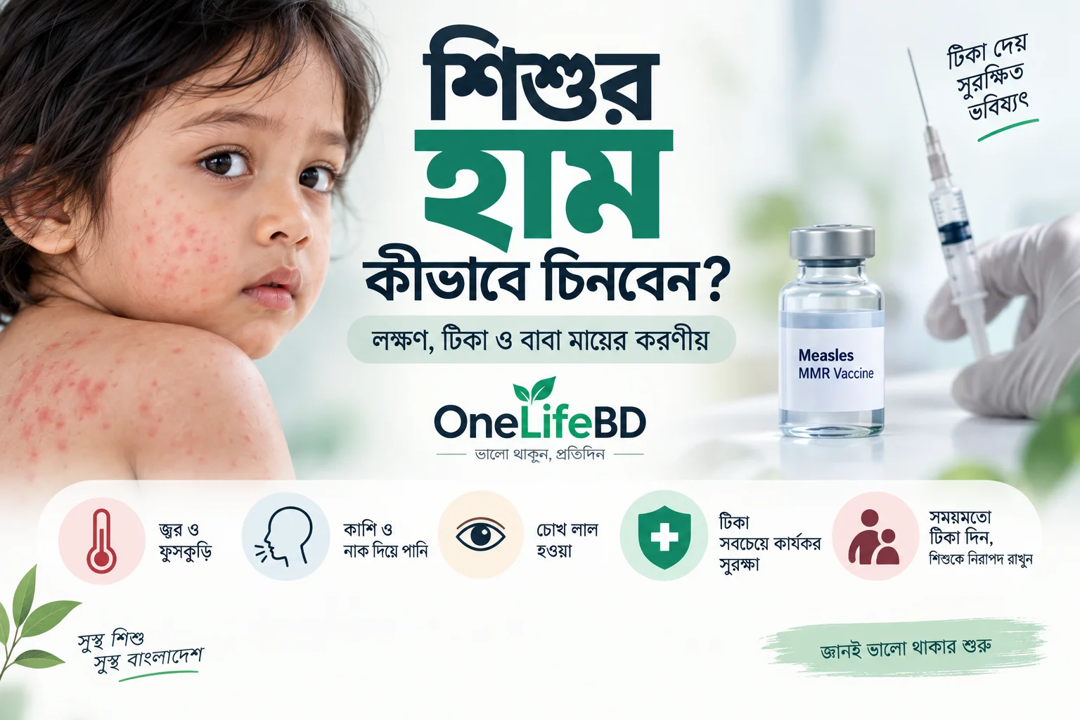 শিশুর হাম কীভাবে চিনবেন? লক্ষণ, টিকা ও বাবা মায়ের করণীয়